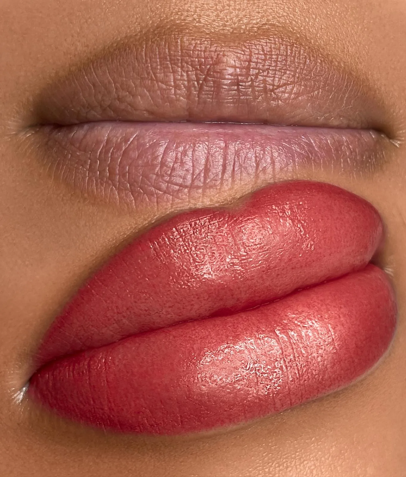 Dark lips before/after